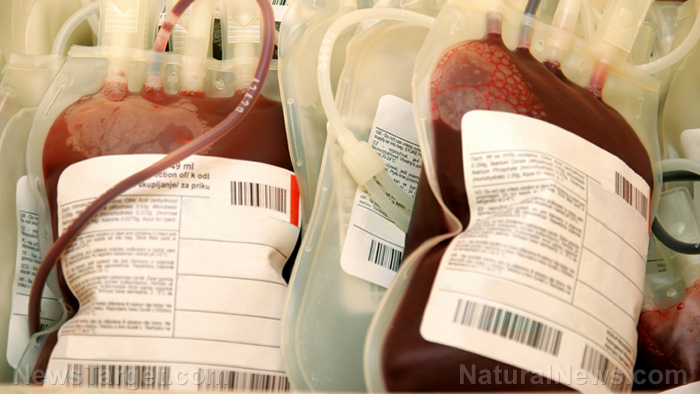 You can now buy blood harvested from young people in America … “Young blood” for sale in San Francisco