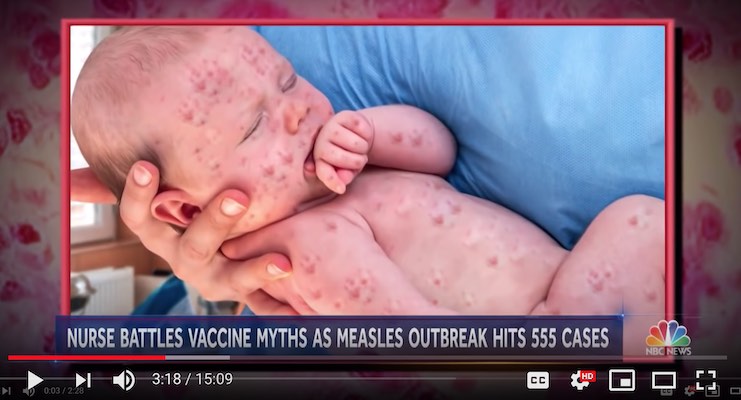 FAKE NEWS!!! CNN and NBC Caught Faking Photo of Baby with Measles