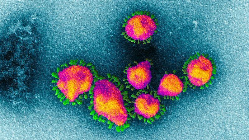 Hubei Doctors Warn Of Even-Deadlier Coronavirus Reinfection Causing Sudden Heart Attacks