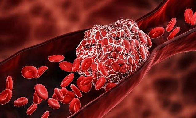 CLOT SHOT DOUBLE DOWN: Big Pharma now pushing medications known to CAUSE more blood clots